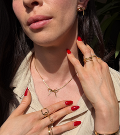 NOEL KETTE